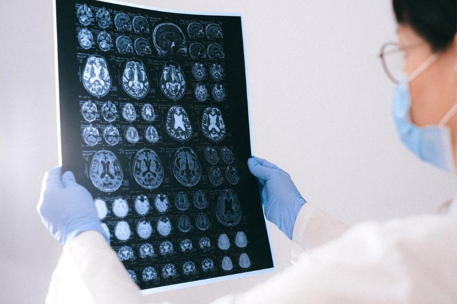 Radiologen beurteilen ein MRT-Bild
